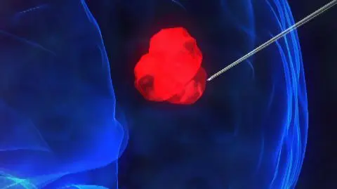 Pogromca nowotworów?