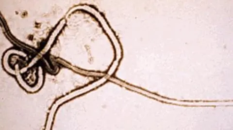 Wirus Ebola znowu zabija