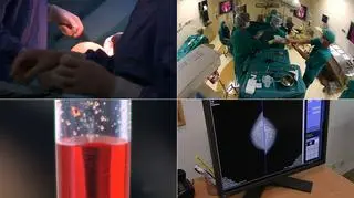 Brak decyzji w sprawie refundacji zabiegu profilaktycznej mastektomii może być wyrokiem dla niektórych pacjentek ("Polska i Świat" z 27.11.2018)