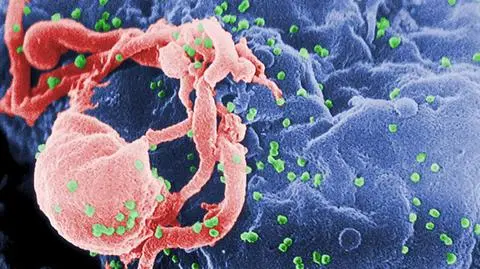 Dziecko wyleczone z HIV? Terapię rozpoczęto już 30 godzin po urodzeniu