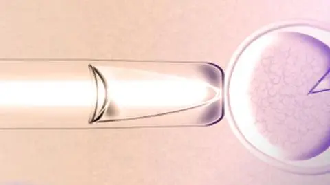 In vitro ponad prawem
