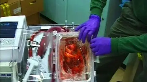 Polska transplantologia wychodzi na prostą