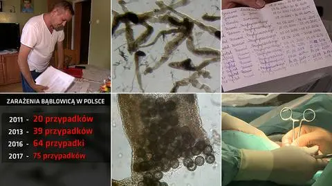 Bąblowica w Polsce - coraz więcej zachorowań. Polska i Świat TVN24