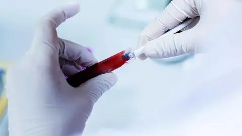 Brytyjscy naukowcy: można się zarazić chorobą Alzheimera