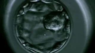 In vitro po raz trzeci