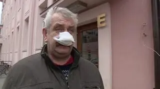 50-letni pan Ireneusz stracił fragment nosa