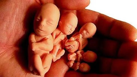 Kościół nie wszystkie aborcje potępia