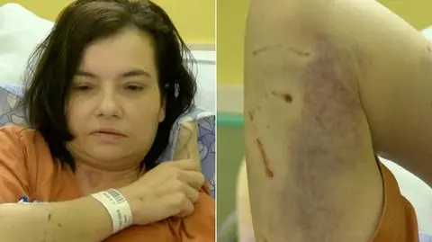 Pogryziona przez agresywne psy 41-letnia mieszkanka Nowej Wsi pod Włocławkiem