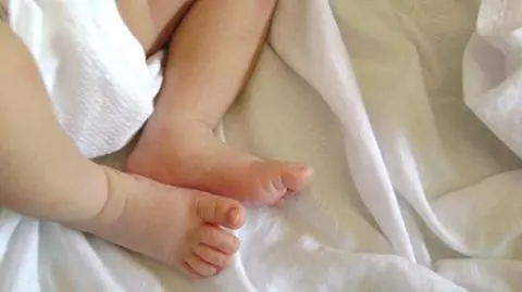 Oblała synka gorącą herbatą, leczyła po swojemu