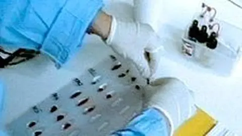 Odkryli nowy wirus wywołujący AIDS