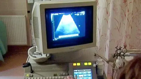 Zmarło dziecko po nieudanej aborcji. Prokuratura: Sprawdzimy, czy nie doszło do przestępstwa