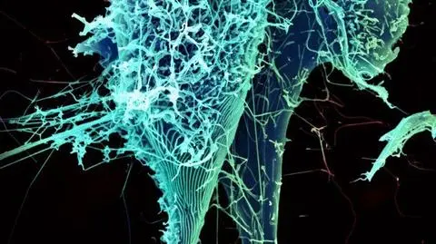 Miał być pod kontrolą. Już ponad 
200 ofiar śmiertelnego wirusa Ebola