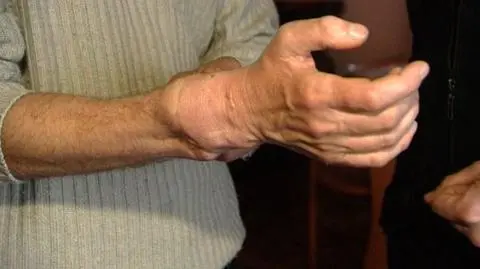 Jest ręka? Jest zdolność do pracy