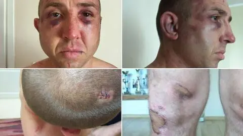 "Myślałem, że stracę przytomność. Zachowywali się jak bandyci, a nie policjanci"