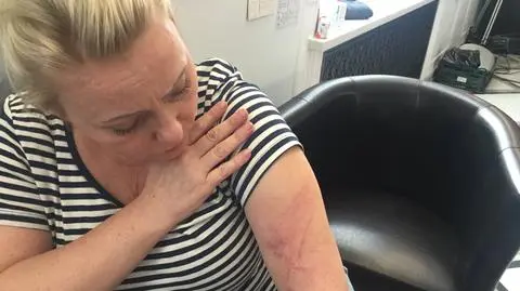 Scheuring-Wielgus publikuje zdjęcie Joanny Hartwich po przepychance