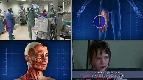 Fakty TVN. Chirurg z USA zrekonstruował nerwy polskim dzieciom