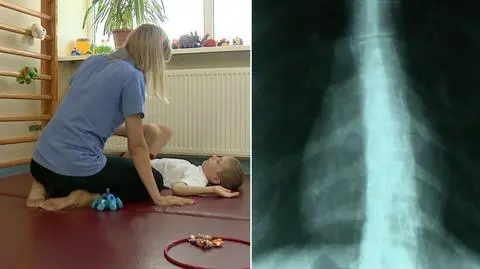 Prawie nie mamy zdrowych pierwszoklasistów. Plaga wad postawy