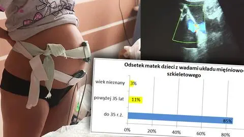NIK apeluje: badania prenatalne dla wszystkich