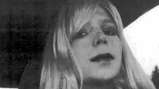 Chelsea Manning spędzi kilka tygodni w szpitalu