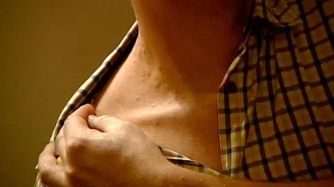 Pluskwy dotkliwie pokąsały pasażera TLK