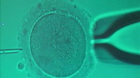 Częstochowa: rusza nabór do programu in vitro, 75 tys. zł dla 15 par