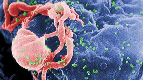 23 dzieci zarażonych HIV po transfuzji