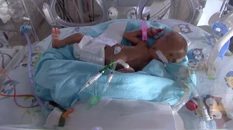 Poznań: Święta w szpitalu Ginekologiczno-Położniczym.