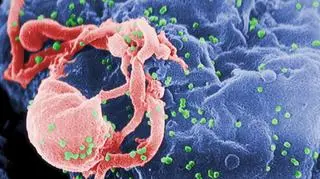 AIDS zagraża również noworodkom