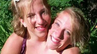 Abigail i Brittany Hensel będą bohaterkami własnego reality-show "Abby & Brittany"