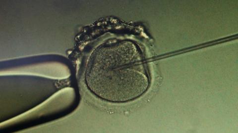 Arłukowicz o rządowym programie in vitro: ponad 200 ciąż. Czekamy na pierwsze dziecko