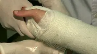 Stracił rękę przez zbyt ciasny gips?