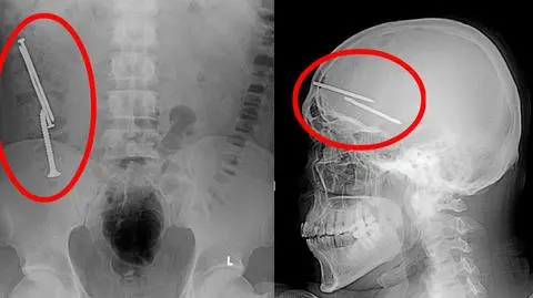 Do czego zdolny jest więzień?