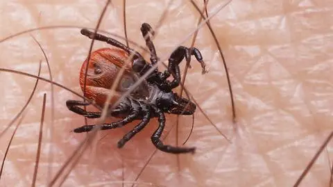 Grzesiowski tłumaczy mechanizm choroby