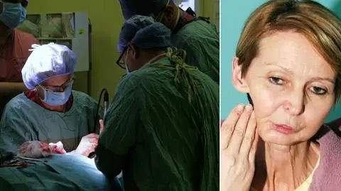 Surgeons from all over the world are learning new face and neck recontruction techniques from Polish doctors