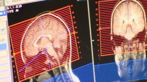 Spór o badania rezonansem magnetycznym. Badanie szybciej, wyniki później