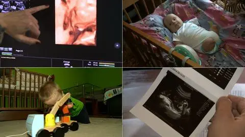Oliwier urodził się bez kończyn. Izba Lekarska umarza sprawę