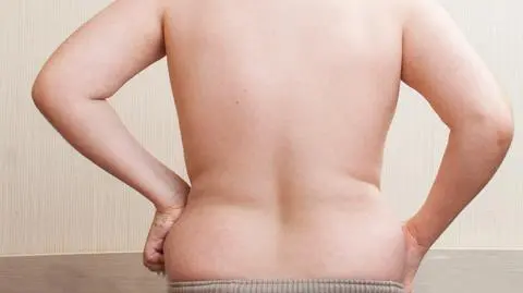 Trzylatek waży 40 kg. Lekarze: takich pacjentów przybywa