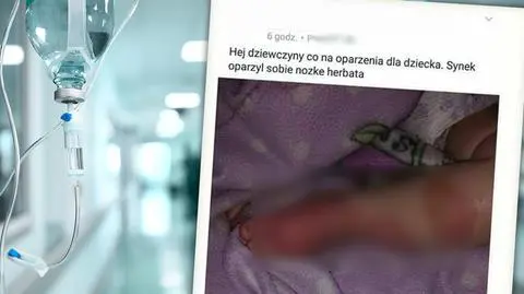 Kobieta uważała, że nie ma potrzeby, by udać się z poparzonym synkiem do lekarza
