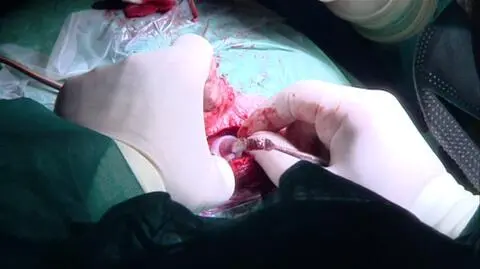 Płacą za błędy lekarskie. 
Złożono już 104 wnioski