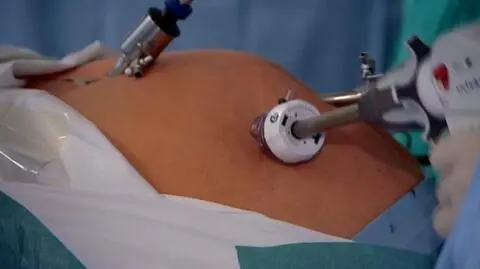 W Centrum Leczenia Otyłości i Chorób Metabolicznych z chorobą walczy się kompleksowo