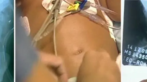 50 igieł w ciele dwulatka