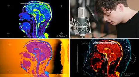 Filmował własny mózg. "Chciałem mieć niesamowity teledysk"