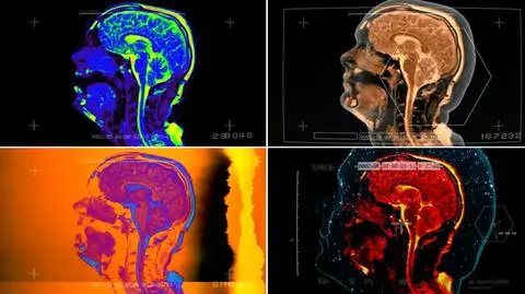 Teledysk "Better Man Than He" został nakręcony przy pomocy skanera MRI w szpitalu w Londynie