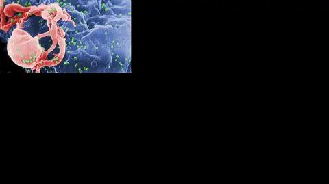 Ukraina. Tysiące ludzi z HIV może zostać bez leczenia