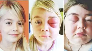 Przez 11 lat nikt nie wiedział na co cierpi Ola 