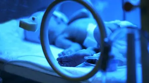 Hiszpania. Pierwsze w Europie dziecko zarażone ziką przyszło na świat