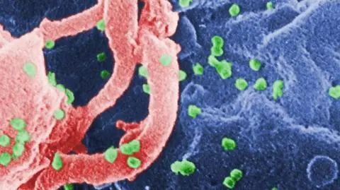 Rozprzestrzenianie wirusa HIV można zatrzymać