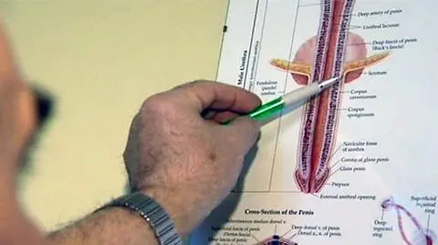 Mężczyzna złamał penis