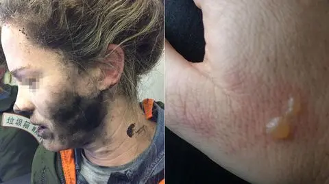 Australia. Słuchawki eksplodowały w czasie lotu