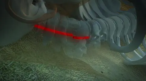 Rdzeń po przerwaniu się nie zrasta